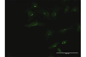 Immunofluorescence of purified MaxPab antibody to B3GALT6 on HeLa cell. (B3GALT6 抗体  (AA 1-329))