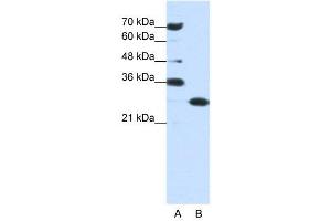WB Suggested Anti-ANP32A  Antibody Titration: 0. (PHAP1 抗体  (Middle Region))
