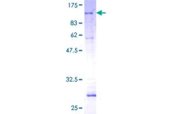 PEPCK Protein (AA 1-640) (GST tag)