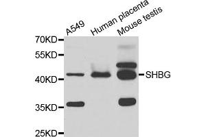 Western blot analysis of extracts of various cell lines, using SHBG antibody (ABIN5975291) at 1/1000 dilution. (SHBG 抗体)