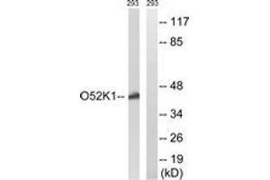 Western blot analysis of extracts from 293 cells, using OR52K1 Antibody. (OR52K1 抗体  (AA 201-250))