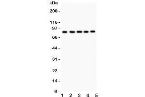 Western blot testing of FOXM1 antibody and Lane 1:  HeLa;  2: COLO320;  3: SW620;  4: SKOV;  5: MCD-7. (FOXM1 抗体  (AA 411-763))