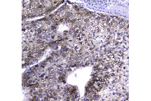 IHC analysis of HGD using anti-HGD antibody . (HGD 抗体  (AA 374-445))