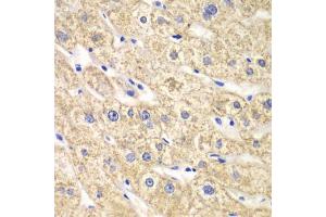 Immunohistochemistry of paraffin-embedded human liver injury using ACADS antibody (ABIN5970342) at dilution of 1/100 (40x lens).