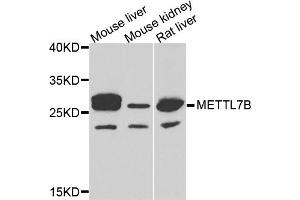 Western blot analysis of extracts of various cell lines, using METTL7B antibody (ABIN5974333) at 1/1000 dilution. (METTL7B 抗体)