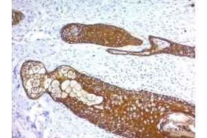 Formalin paraffin human skin stained with Basic Cytokeratin antibody (KRTH/1076). (Keratin Basic 抗体)