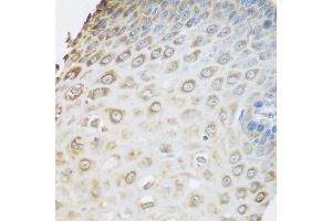 Immunohistochemistry of paraffin-embedded human esophagus using GRPEL2 antibody at dilution of 1:100 (40x lens). (GRPEL2 抗体)