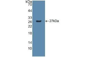 Detection of Recombinant GSTm2, Human using Polyclonal Antibody to Glutathione S Transferase Mu 2 (GSTM2) (GSTM2 抗体  (AA 3-218))