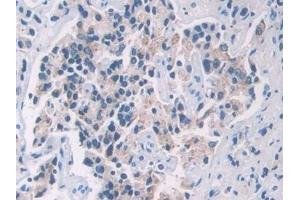 Immunohistochemistry (IHC) image for anti-Profilin 2 (PFN2) (AA 5-140) antibody (ABIN7437743)