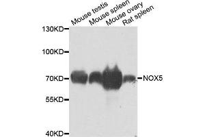 Western blot analysis of extracts of various cell lines, using NOX5 antibody. (NOX5 抗体)