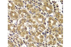 Immunohistochemistry of paraffin-embedded Human gastric using HSPE1 Polyclonal Antibody at dilution of 1:100 (40x lens). (HSPE1 抗体)