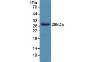 WB of Protein Standard: different control antibodies against Highly purified E. (alpha 2 Macroglobulin CLIA Kit)