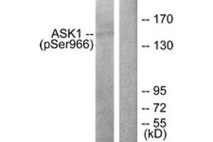 Western blot analysis of extracts from 293 cells treated with TNF(20ng/ml)+calyculinA(50nM) 15', using ASK1 (Phospho-Ser966) Antibody. (ASK1 抗体  (pSer966))