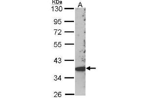 WB Image Sample (30 ug of whole cell lysate) A: Hep G2 , 10% SDS PAGE SCAP2 antibody antibody diluted at 1:1000 (SKAP2 抗体  (C-Term))