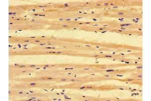 Immunohistochemistry of paraffin-embedded human heart tissue using ABIN7163828 at dilution of 1:100 (PKD1L3 抗体  (AA 22-194))