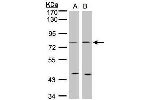 WB Image Sample(30 ug whole cell lysate) A:293T B:MOLT4 , 7. (PTGS2 抗体  (C-Term))