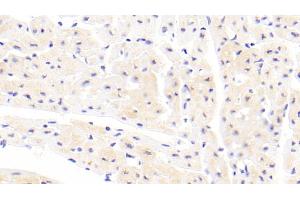 Detection of CFL2 in Human Cardiac Muscle Tissue using Polyclonal Antibody to Cofilin 2, Muscle (CFL2) (Cofilin 2 抗体  (AA 1-156))