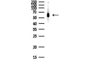 anti-DEAD (Asp-Glu-Ala-Asp) Box Polypeptide 5 (DDX5) (C-Term) antibody