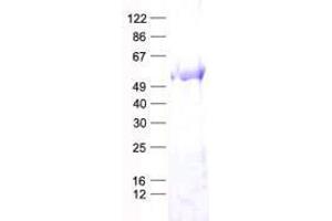 Western Blotting (WB) image for tRNA Methyltransferase 5 (TRMT5) protein (His tag) (ABIN2734359)