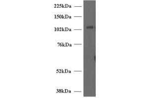 Image no. 1 for anti-Unc-13 Homolog D (UNC13D) (Internal Region) antibody (ABIN374716)