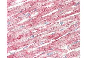 Human, Heart: Formalin-Fixed Paraffin-Embedded (FFPE). (FLII 抗体  (AA 1116-1165))