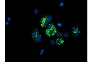 Anti-DLD mouse monoclonal antibody (ABIN2454952) immunofluorescent staining of COS7 cells transiently transfected by pCMV6-ENTRY DLD (RC200639). (DLD 抗体)