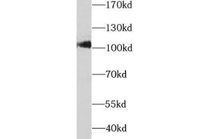 Western blot analysis of rat liver tissue subjected to SDS-PAGE, using SARDH antibody (1/1000 dilution). (SARDH 抗体)