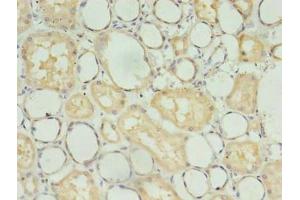 Immunohistochemistry of paraffin-embedded human kidney tissue using ABIN7173734 at dilution of 1:100 (TBCB 抗体  (AA 1-244))