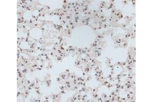Immunohistochemistry (Paraffin-embedded Sections) (IHC (p)) image for anti-Zinc Finger Protein 416 (ZNF416) antibody (ABIN7258204)