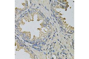 Immunohistochemistry of paraffin-embedded human prostate using LITAF Antibody (ABIN5973182) at dilution of 1/100 (40x lens). (LITAF 抗体)