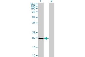 Western Blot analysis of RABL4 expression in transfected 293T cell line by RABL4 MaxPab polyclonal antibody. (RABL4 抗体  (AA 1-186))