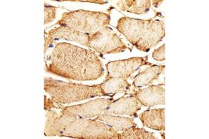 Iunohistochemical analysis of paraffin-embedded H.
