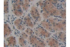 #VALUE! (Thrombopoietin 抗体  (AA 25-298))