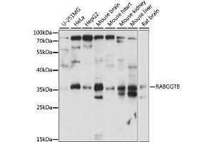 Western blot analysis of extracts of various cell lines, using RABGGTB antibody (ABIN7269784) at 1:1000 dilution. (RABGGTB 抗体  (AA 1-331))