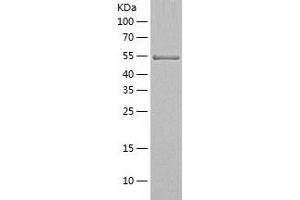 Ribophorin II Protein (RPN2) (AA 23-540) (His tag)