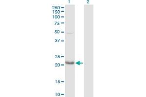 Western Blot analysis of GLO1 expression in transfected 293T cell line by GLO1 polyclonal antibody (A01).