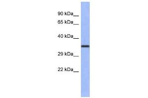 WNT4 antibody used at 1 ug/ml to detect target protein. (WNT4 抗体  (Middle Region))