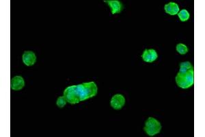 Immunofluorescence staining of MCF-7 cells with ABIN7168018 at 1:100, counter-stained with DAPI. (RHOB 抗体  (AA 1-196))