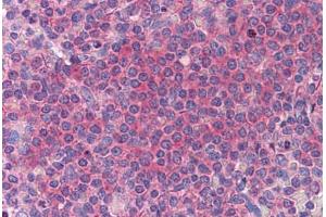 Human Spleen: Formalin-Fixed, Paraffin-Embedded (FFPE) (HYI 抗体  (AA 1-218))
