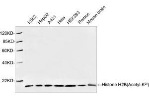 Western blot analysis of cell and tissue lysates using 1 µg/mL Antibodies-Online Rabbit Anti-Histone H2B (Acetyl-K20) Polyclonal Antibody (ABIN398911) The signal was developed with IRDyeTM 800 Conjugated Goat Anti-Rabbit IgG. (Histone H2B 抗体  (Lys20))