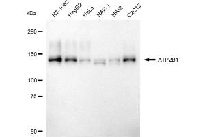 Western blotting analysis using ATP2B1 antibody (ABIN7797695).