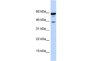 WB Suggested Anti-PPP1R8 Antibody Titration:  0. (PPP1R8 抗体  (Middle Region))