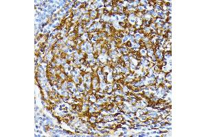 Immunohistochemistry of paraffin-embedded human tonsil using Casein Kinase 1 alpha (Casein Kinase 1 alpha (CSNK1)) antibody (6225) at dilution of 1:100 (40x lens). (CSNK1A1 抗体  (AA 100-200))
