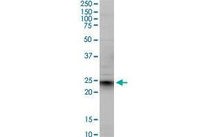 EFNA5 monoclonal antibody (M01), clone 1F12. (Ephrin A5 抗体  (AA 114-203))