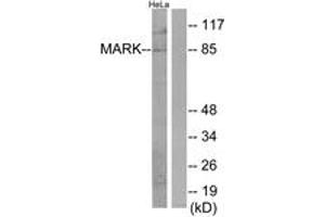 Western blot analysis of extracts from HeLa cells, using MARK Antibody. (MARK1 抗体  (AA 121-170))