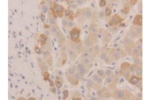 DAB staining on IHC-P; Samples: Human Liver Tissue (NEU1 抗体  (AA 47-415))