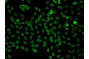 Immunofluorescence analysis of A549 cell using PLCXD2 antibody. (PLCXD2 抗体)