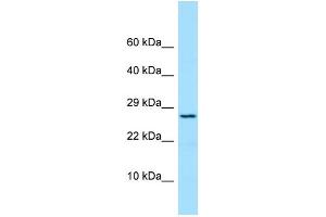 Host: Rabbit Target Name: PRDX4 Sample Type: COLO205 Whole Cell lysates Antibody Dilution: 1. (Peroxiredoxin 4 抗体  (N-Term))