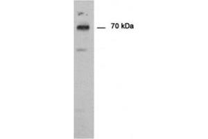 Immunodetection of PAD type 1 using PADI1 antibody in Human epedermis as a 70 kDa protein. (PADI1 抗体)