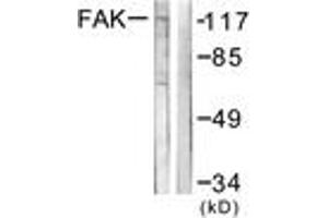Western blot analysis of extracts from NIH-3T3 cells, using FAK (Ab-576) Antibody. (FAK 抗体  (AA 542-591))